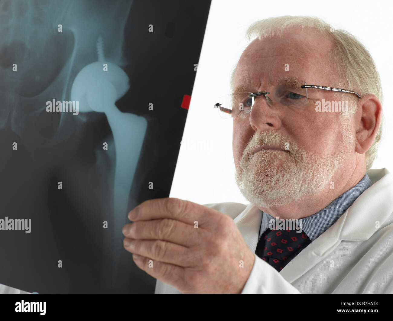 MALE DOCTOR WITH XRAY OF ARTIFICIAL HIP JOINT Stock Photo
