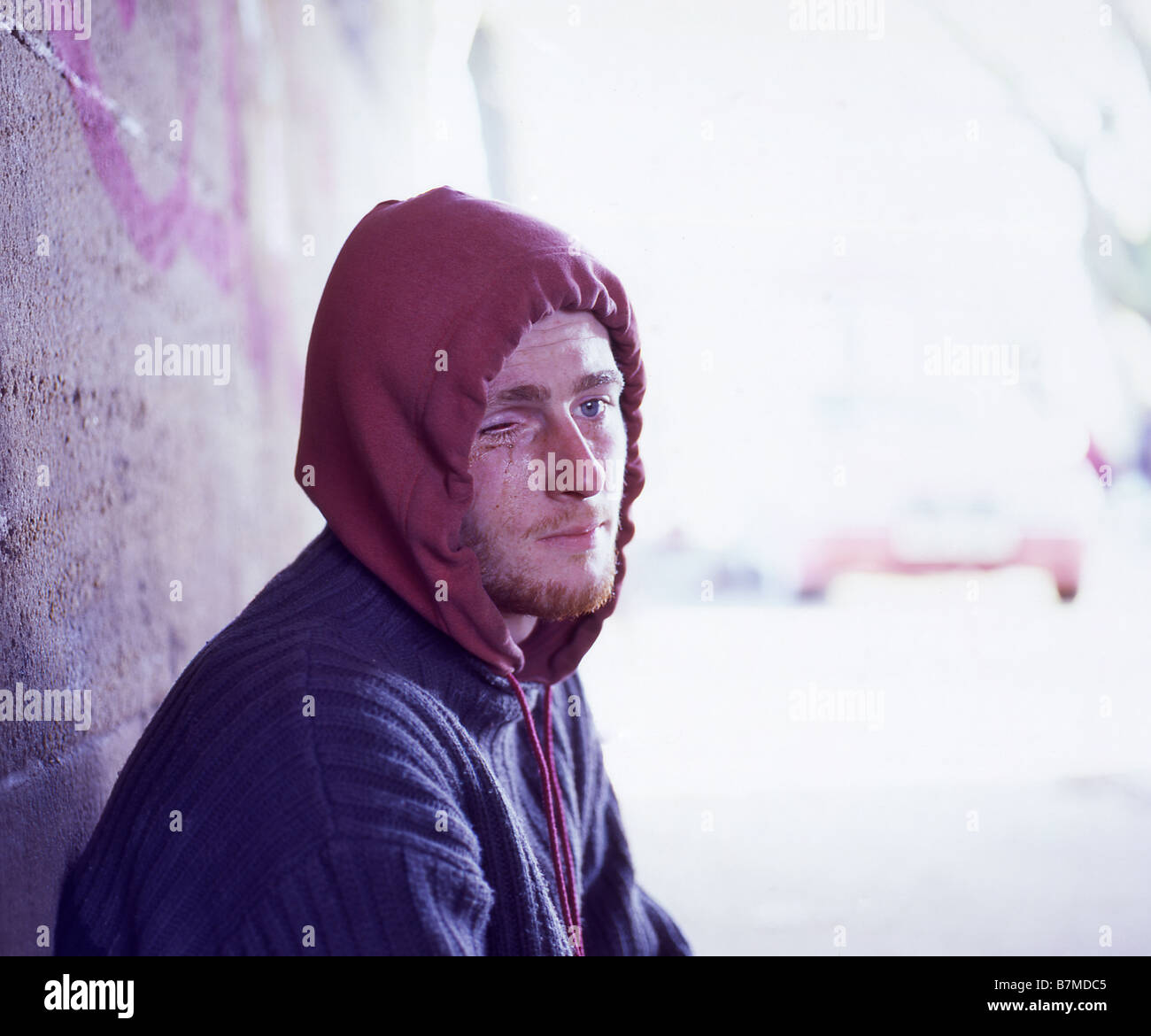 Homeless man with only one eye Stock Photo - Alamy