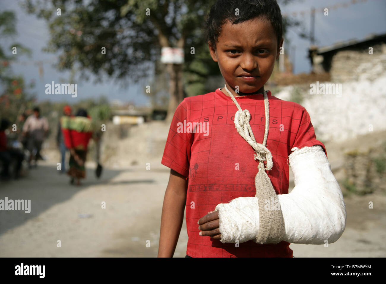 Boy broken arm in plaster cast Stock Photo