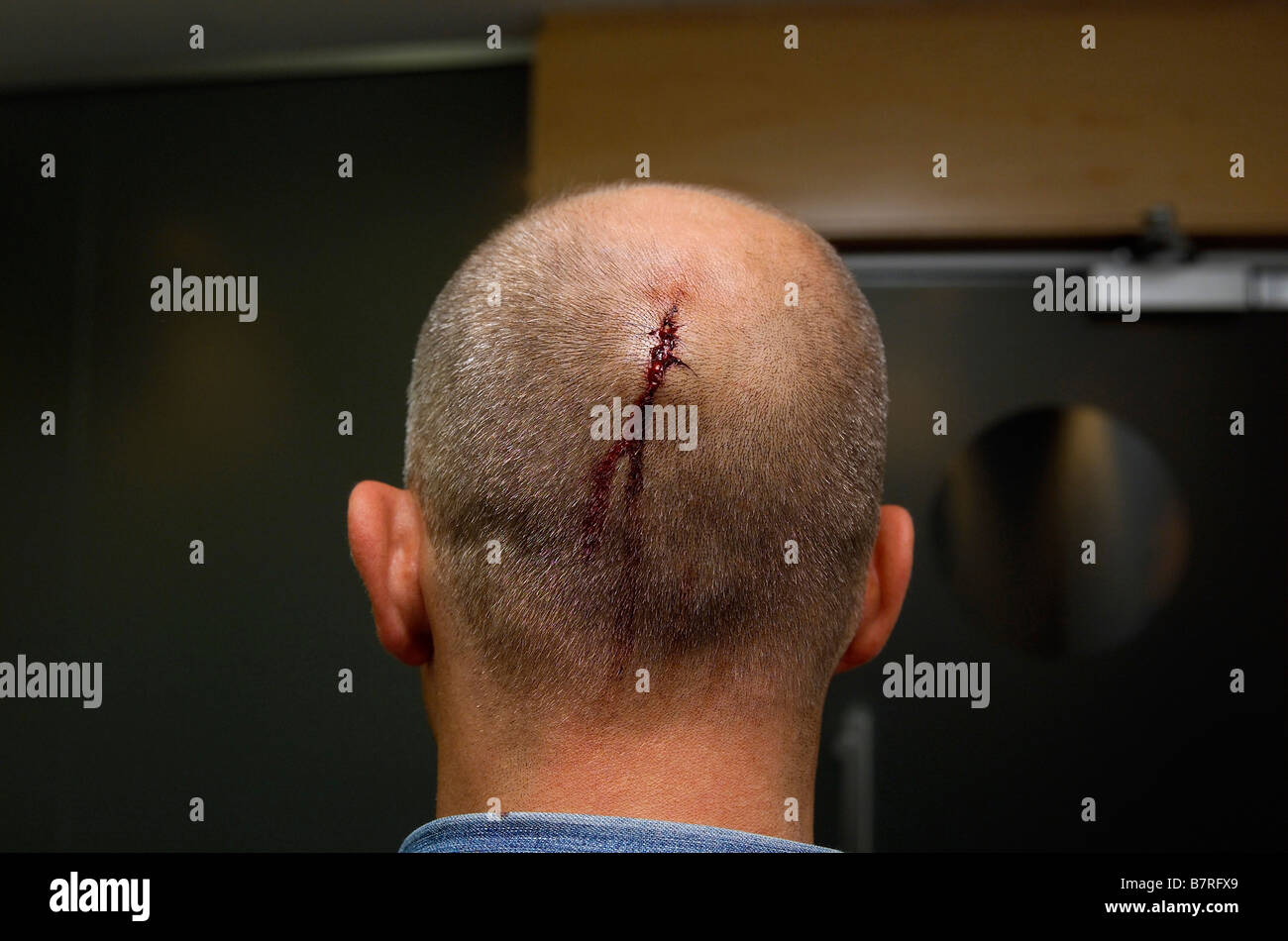 Man with a scar. Stock Photo