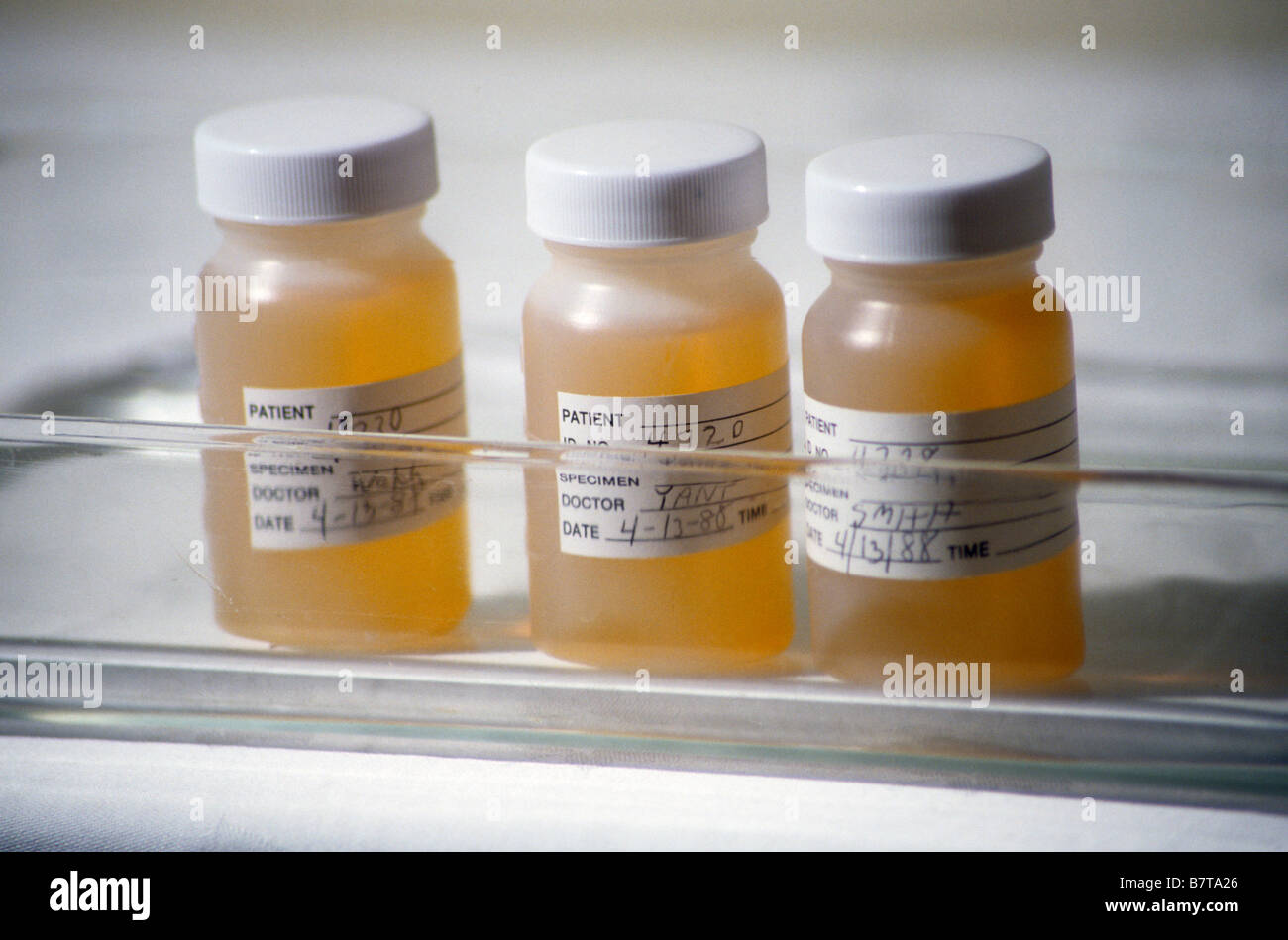 Three bottles or urine samples on shelf in doctor's office Stock Photo Alamy