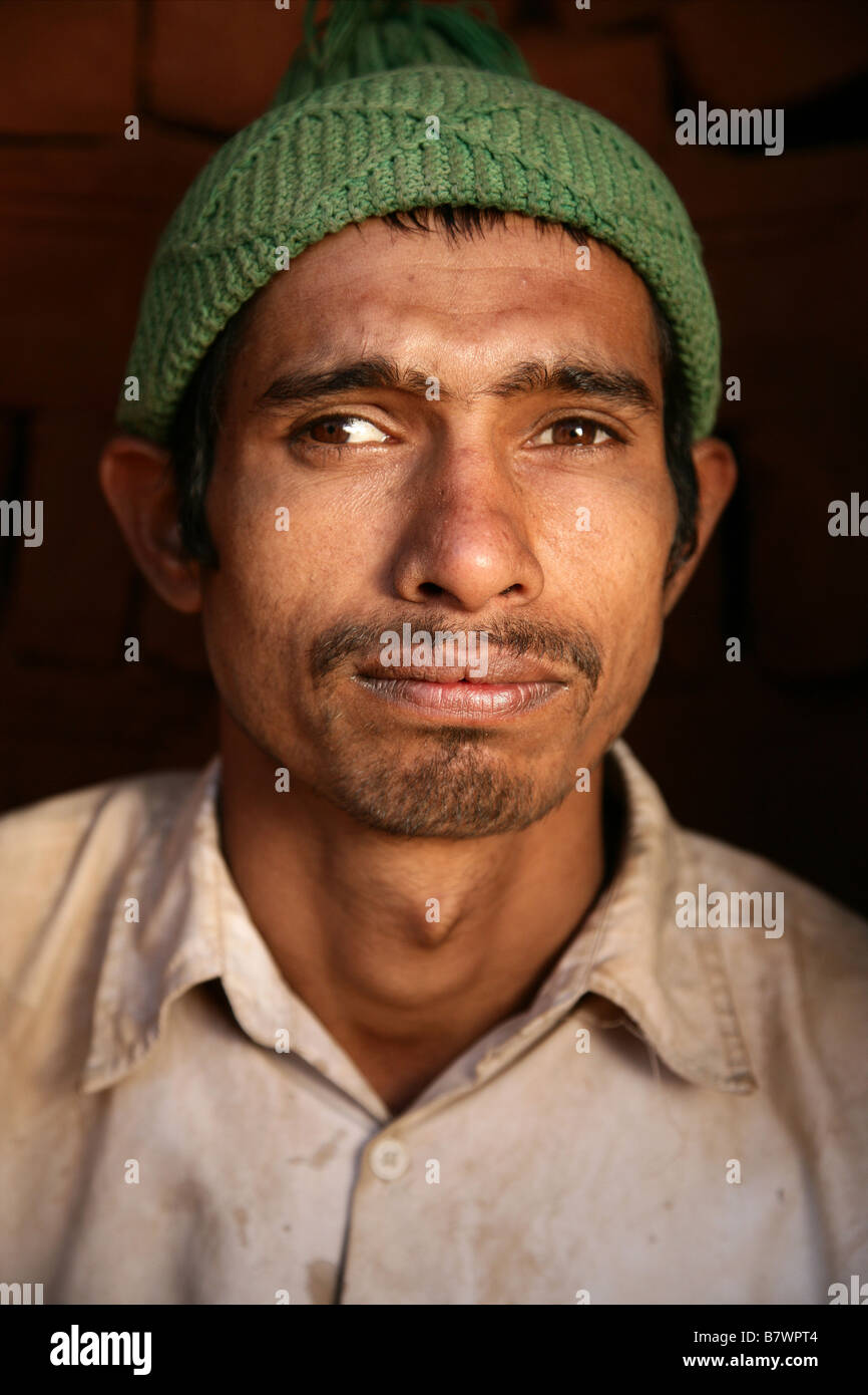 Man with strabismus Nepal Stock Photo