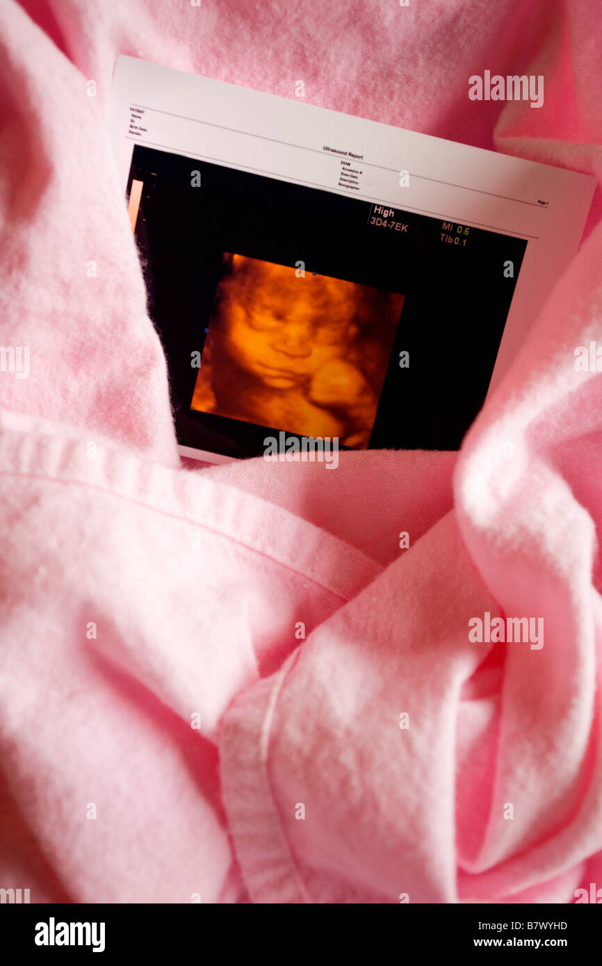 Three dimensional ultrasound photo Stock Photo