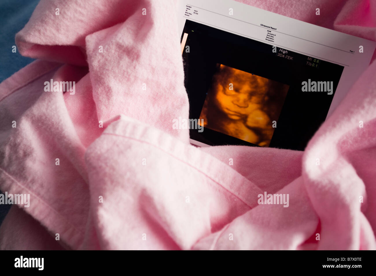 Three dimensional ultrasound photo Stock Photo - Alamy