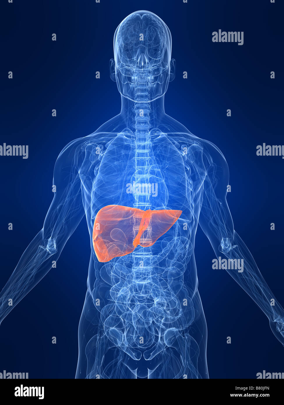 Liver cirrhosis hi-res stock photography and images - Alamy