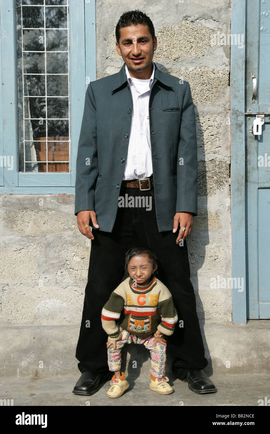 “eighteen year old Khagendra Thapa Magar the worlds smallest man”. Stock Photo