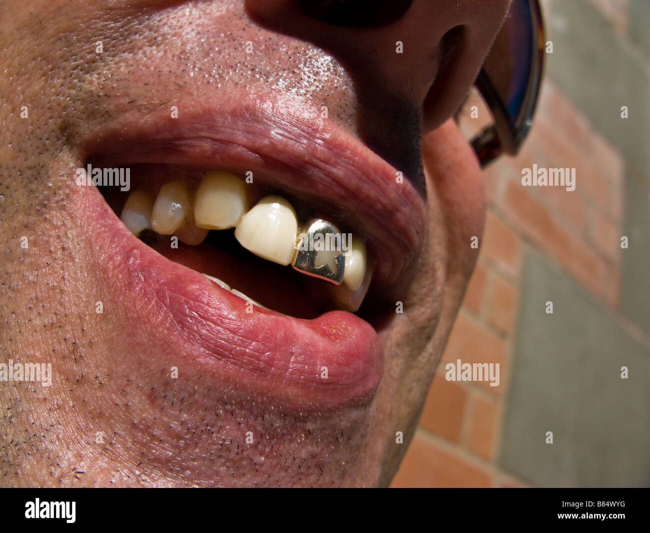 Gold Tooth Smile Stock Photos & Gold Tooth Smile Stock Images - Alamy