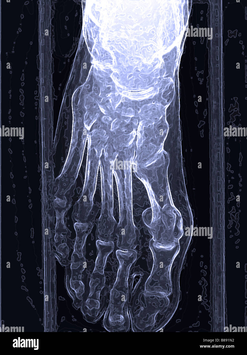 Illustration of an Xray of a human foot Stock Photo