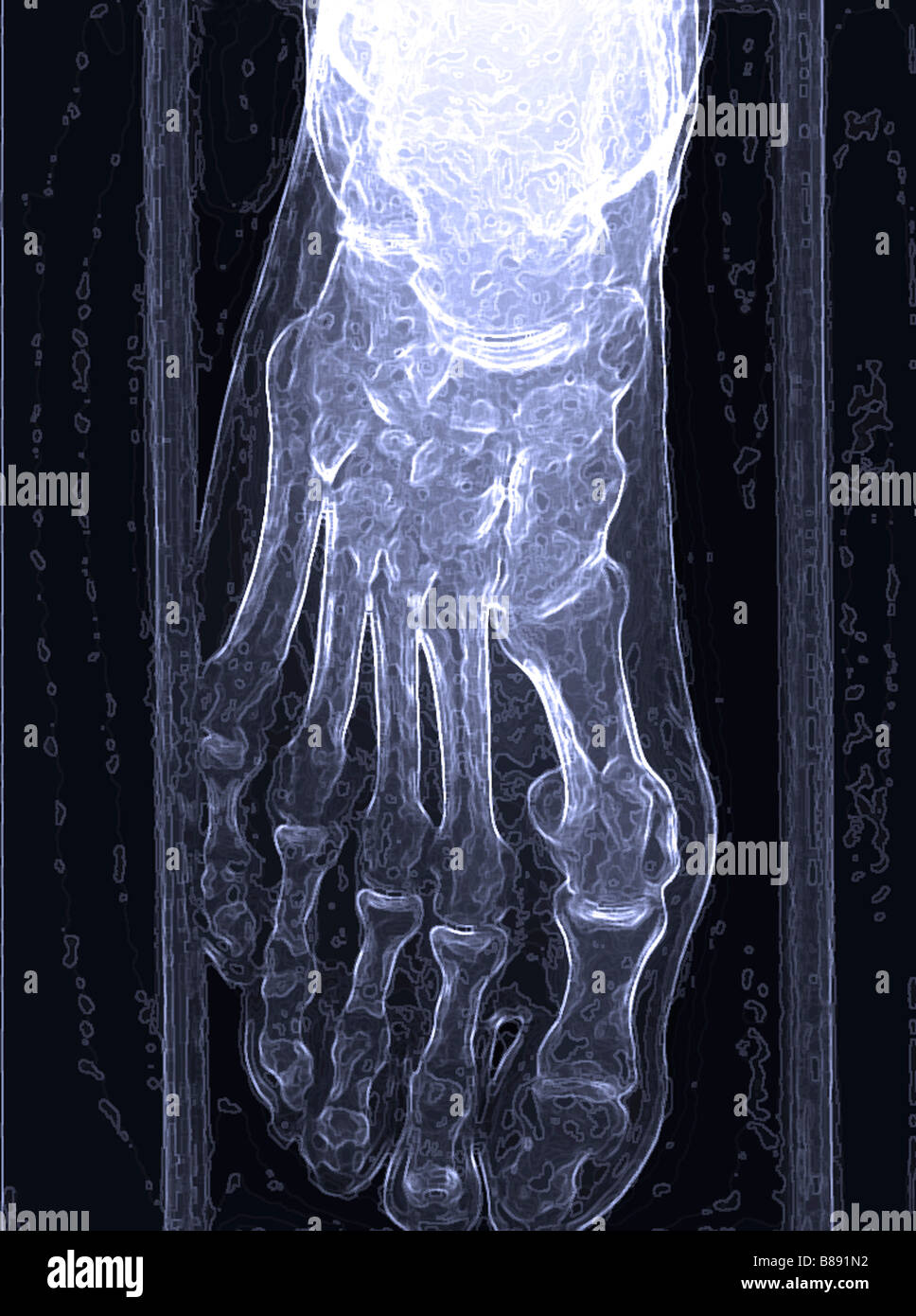 Foot xray hires stock photography and images Alamy