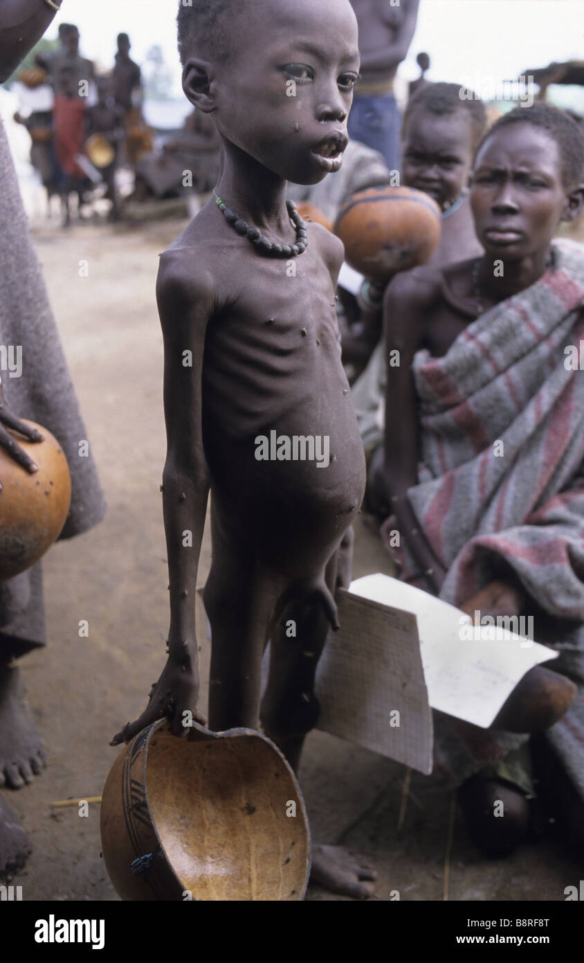 Starving ethiopian children