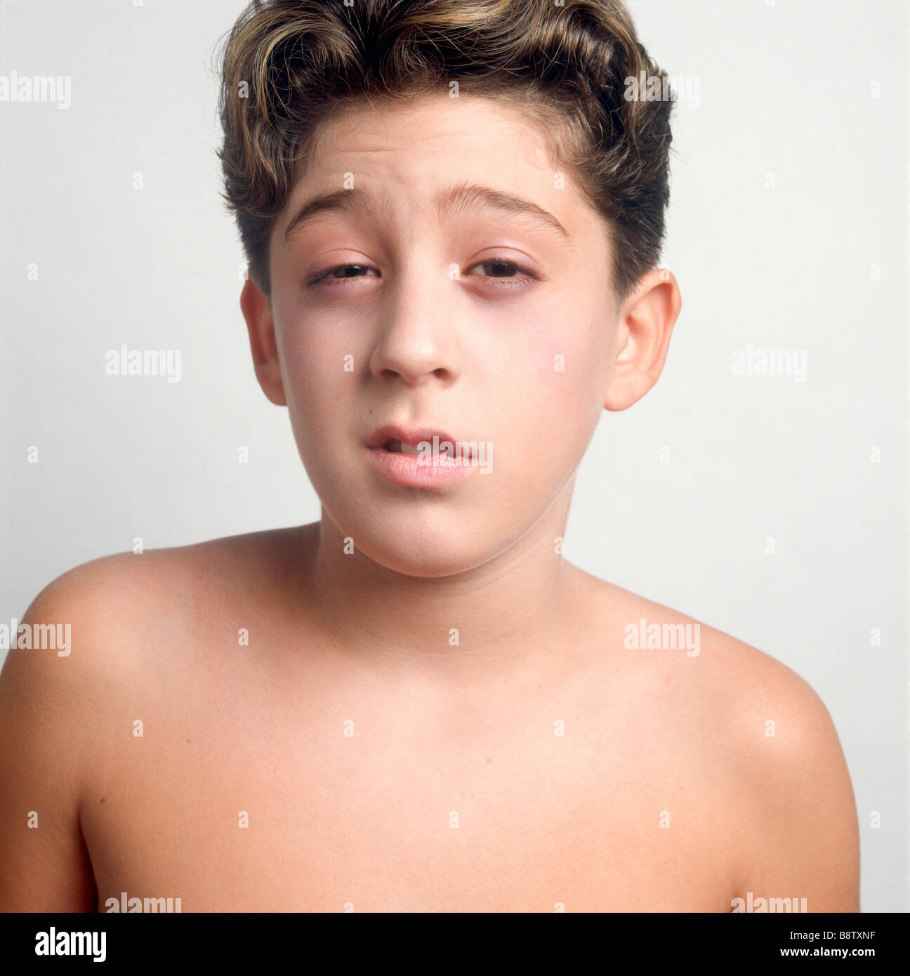 Sick boy hi-res stock photography and images - Alamy