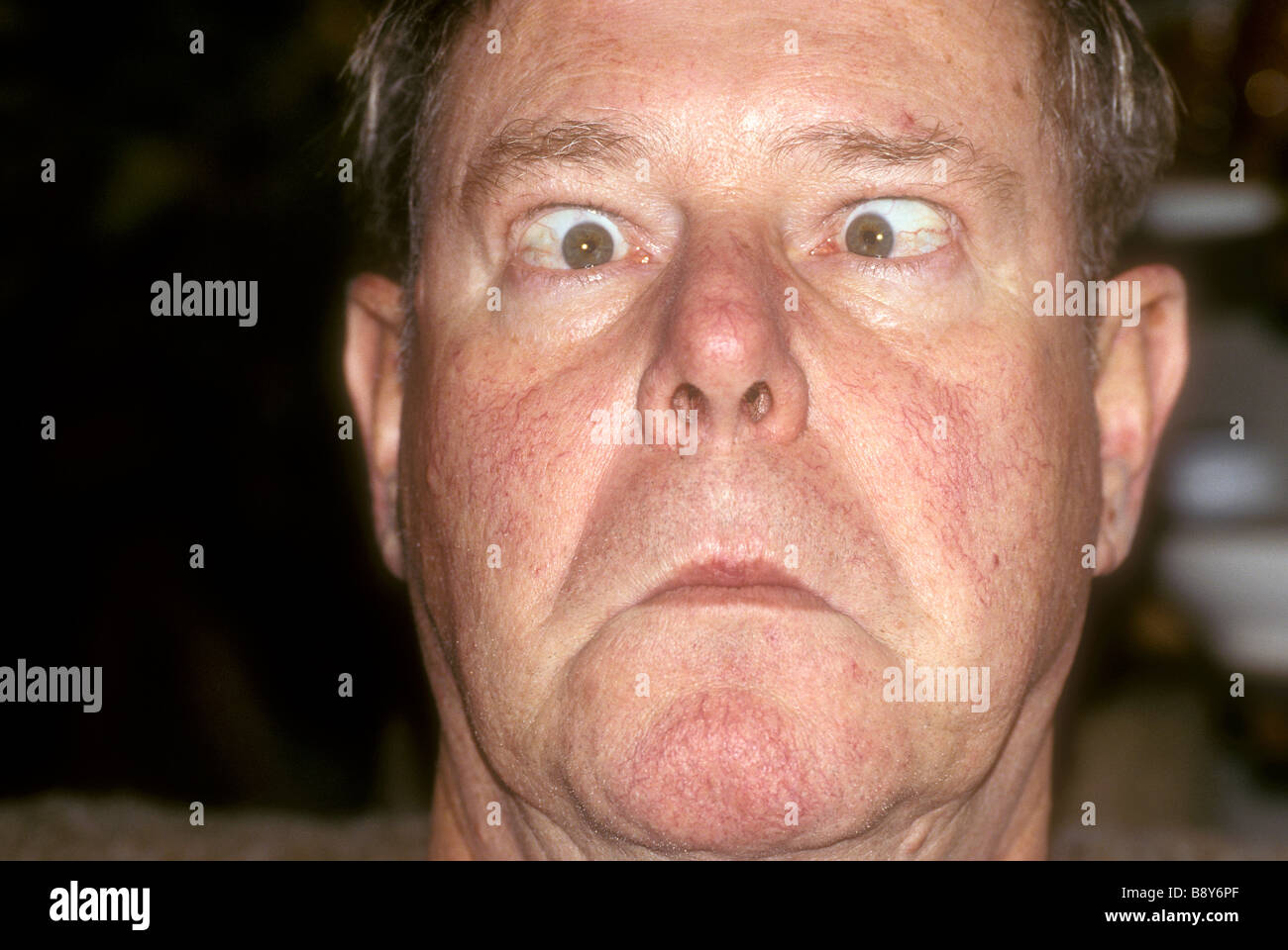 Cross eyed Man Stock Photo Alamy