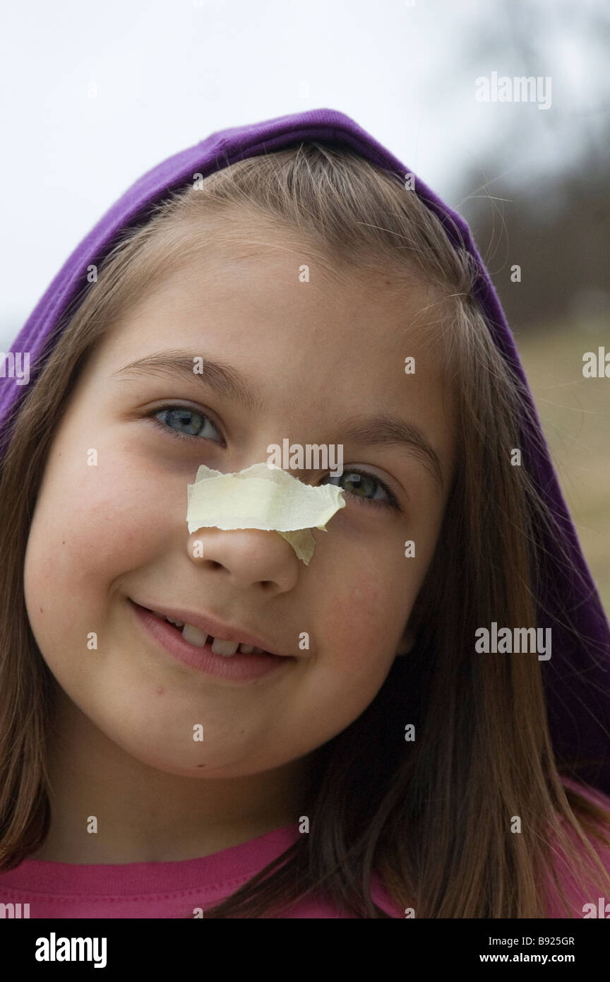 Little girl with bandage on her nose Stock Photo Alamy