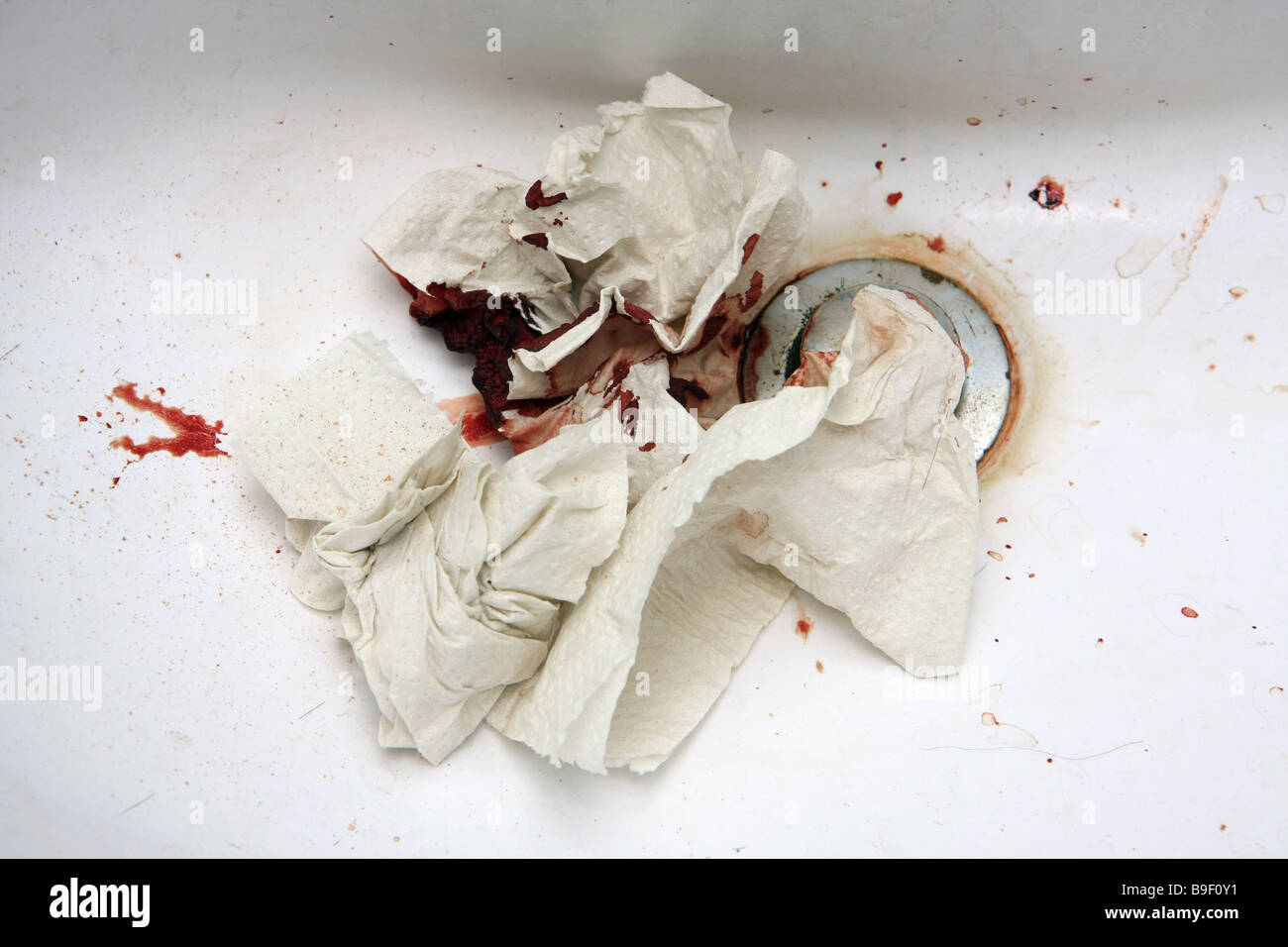 Bloody toilet paper, due to a bleeding nose, thrown in the sink. Stock Photo