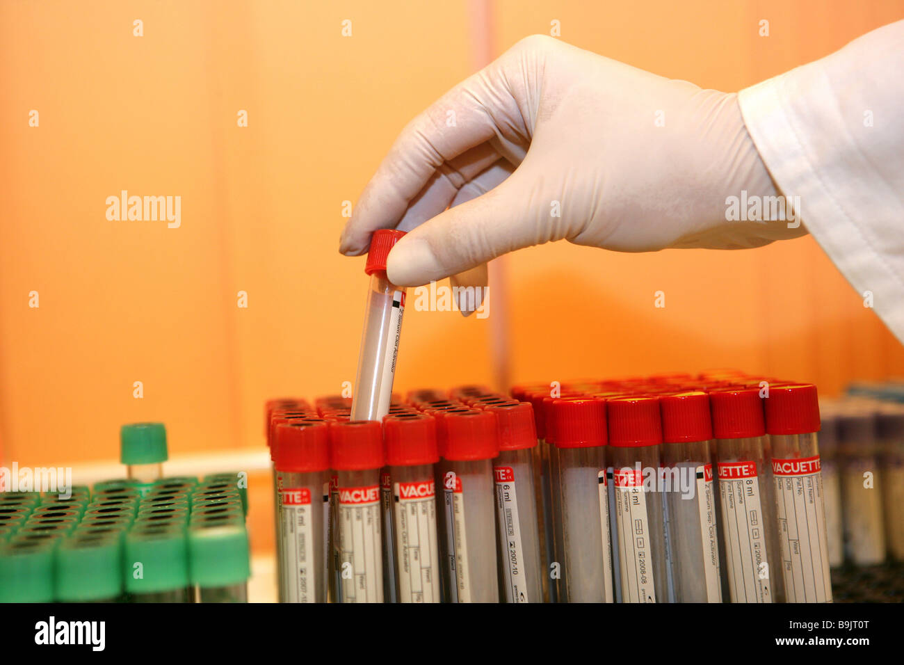 Blood samples laboratory hand detail Stock Photo Alamy