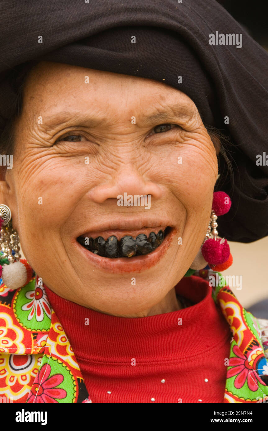 The black teeth of a black lu hilltribe woman in tam duong vietnam