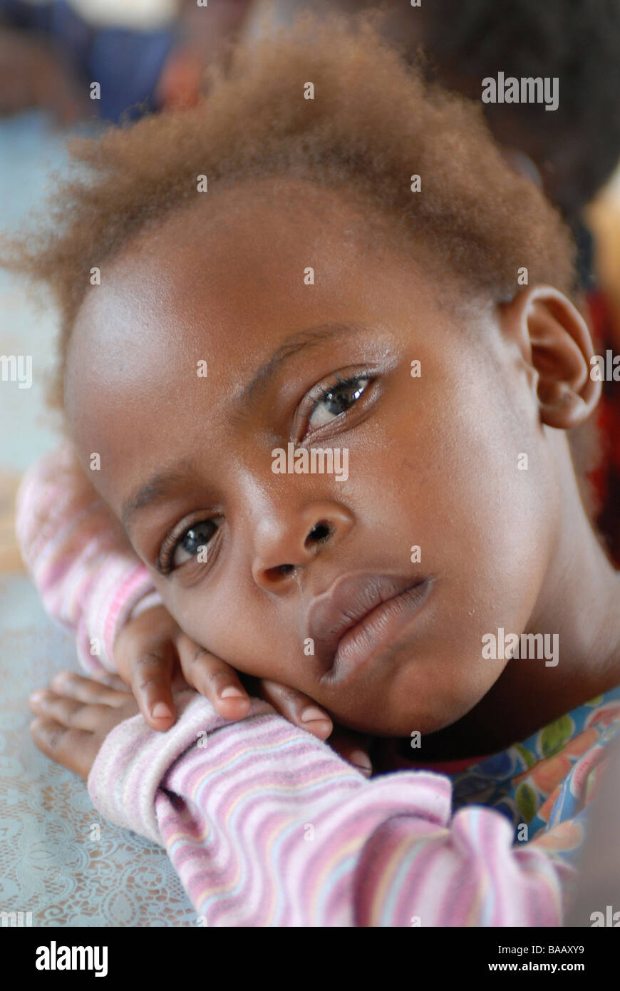 Girl infected with HIV, Lusaka, Zambia Stock Photo