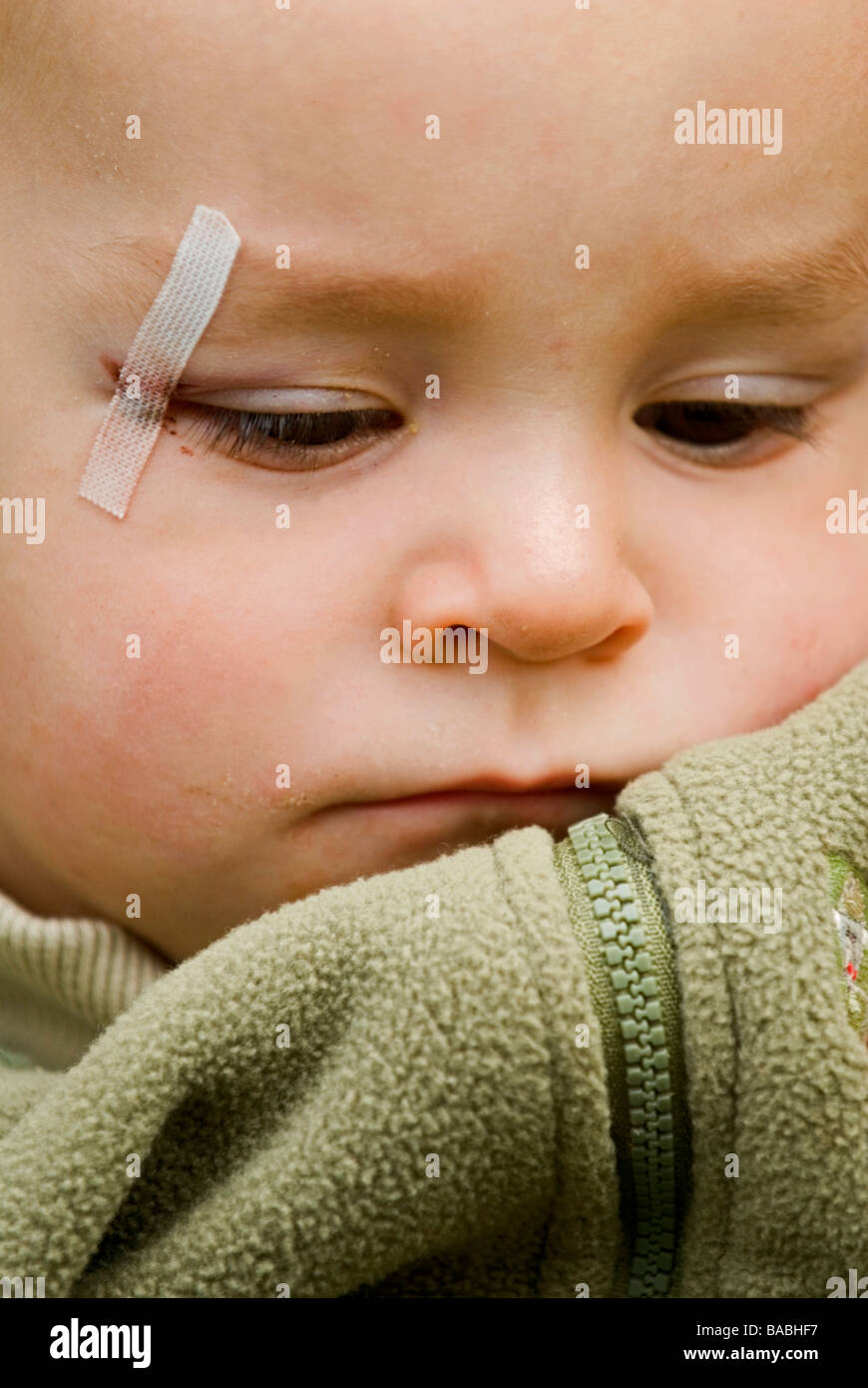 A little boy with a wounded eye Sweden Stock Photo