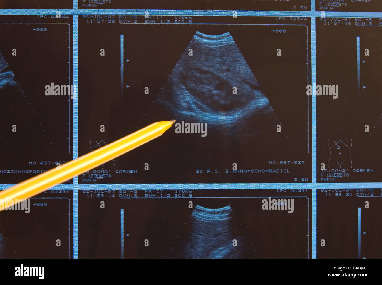 ultrasound examination Stock Photo