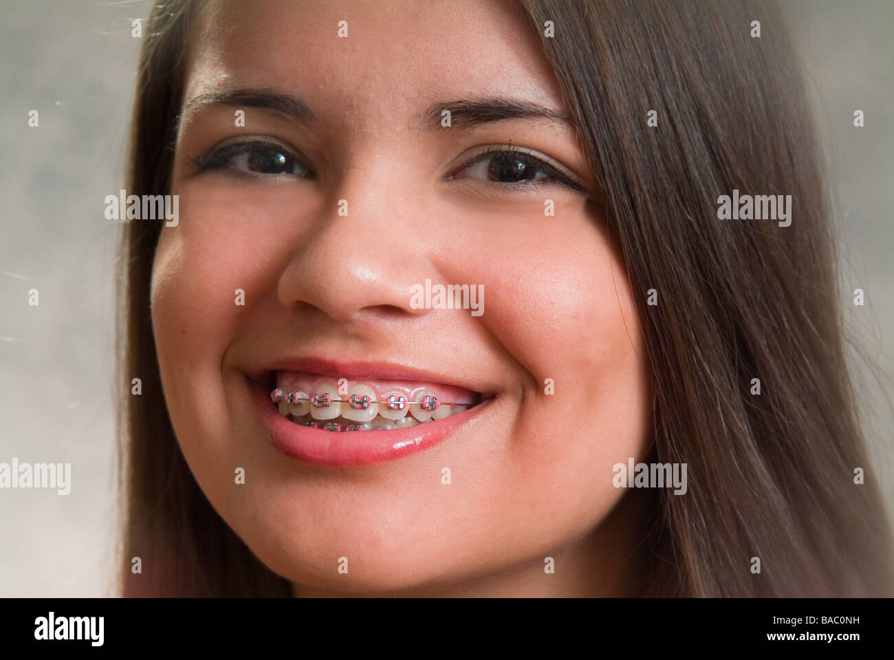 orthodontists Stock Photo Alamy