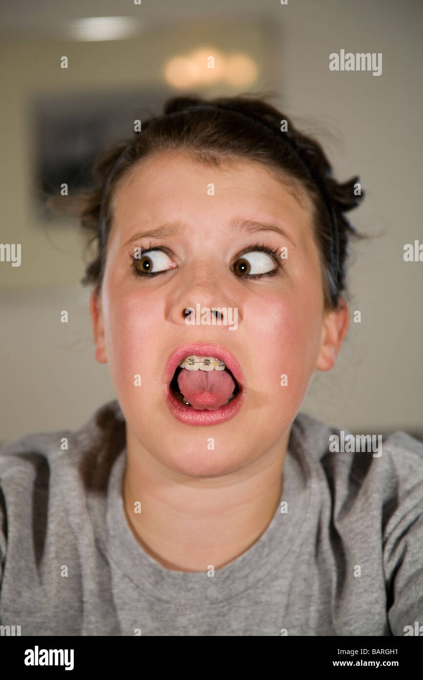 teen braces selfie A pretty teenage girl wearing braces showing displaying a look of fear or  horror and showing her tongue Stock Photo - Alamy