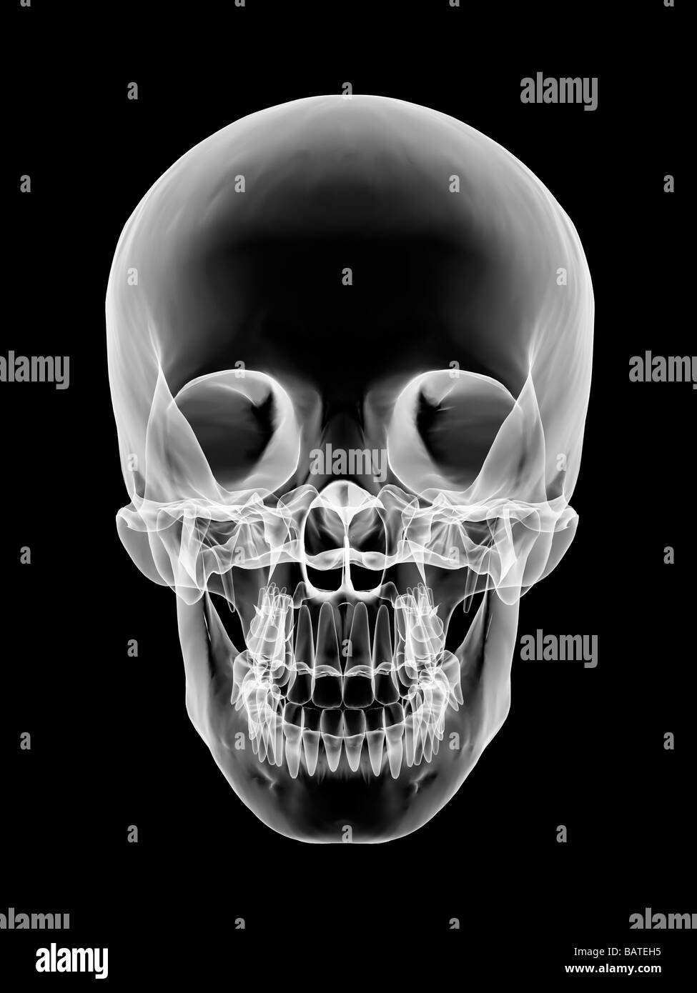 Human skull, computer X-ray artwork. Stock Photo