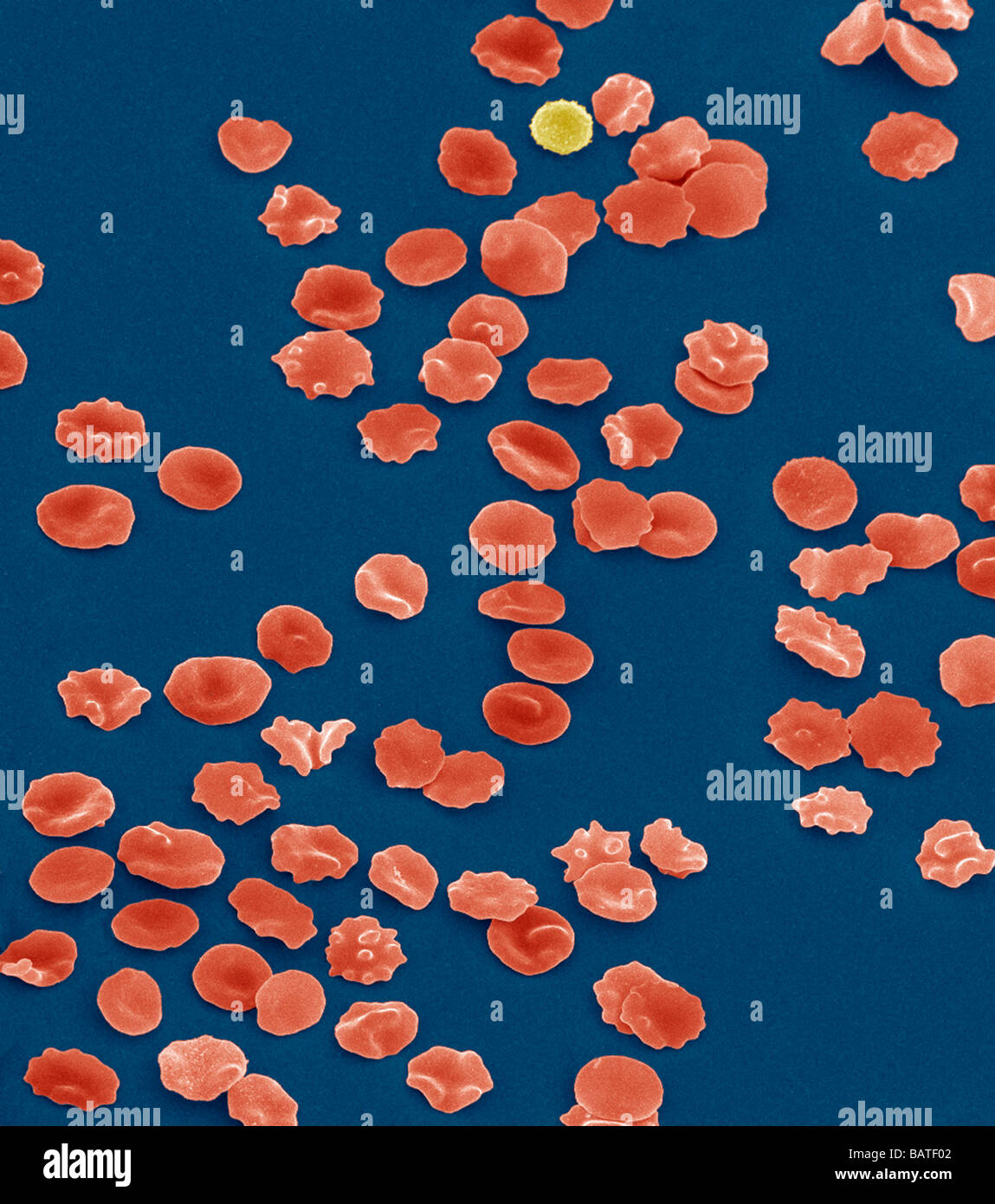 Crenated Red Blood Cells Light Microscope