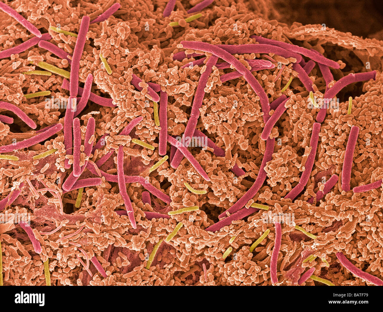 Dental plaque, coloured scanning electronmicrograph (SEM). Plaque consists of bacteria embedded in a glycoprotein matrix. Stock Photo