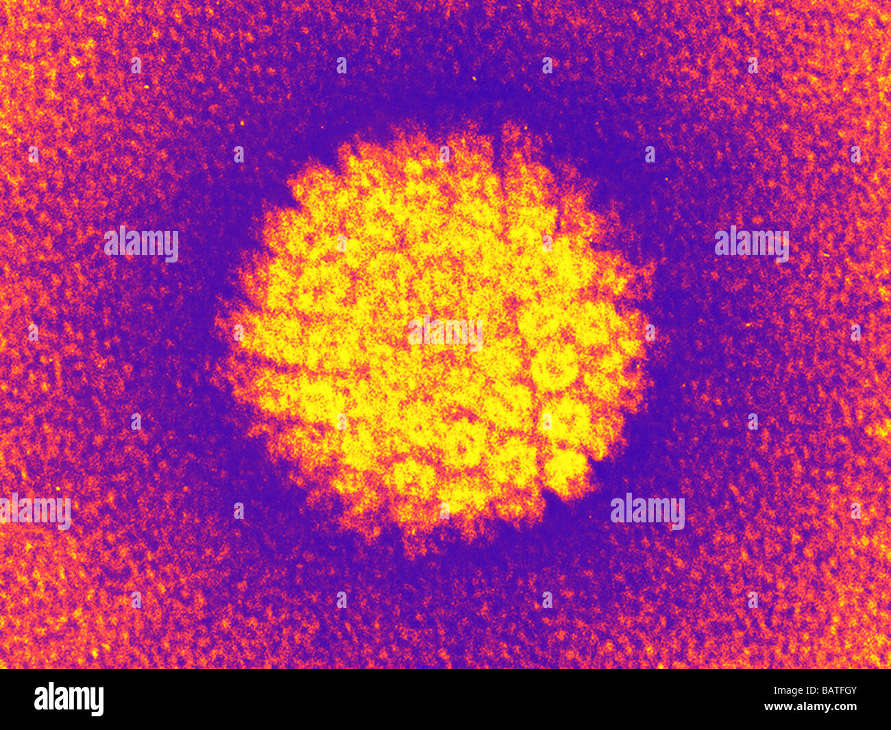 Human papilloma virus (HPV), coloured transmissionelectron micrograph
