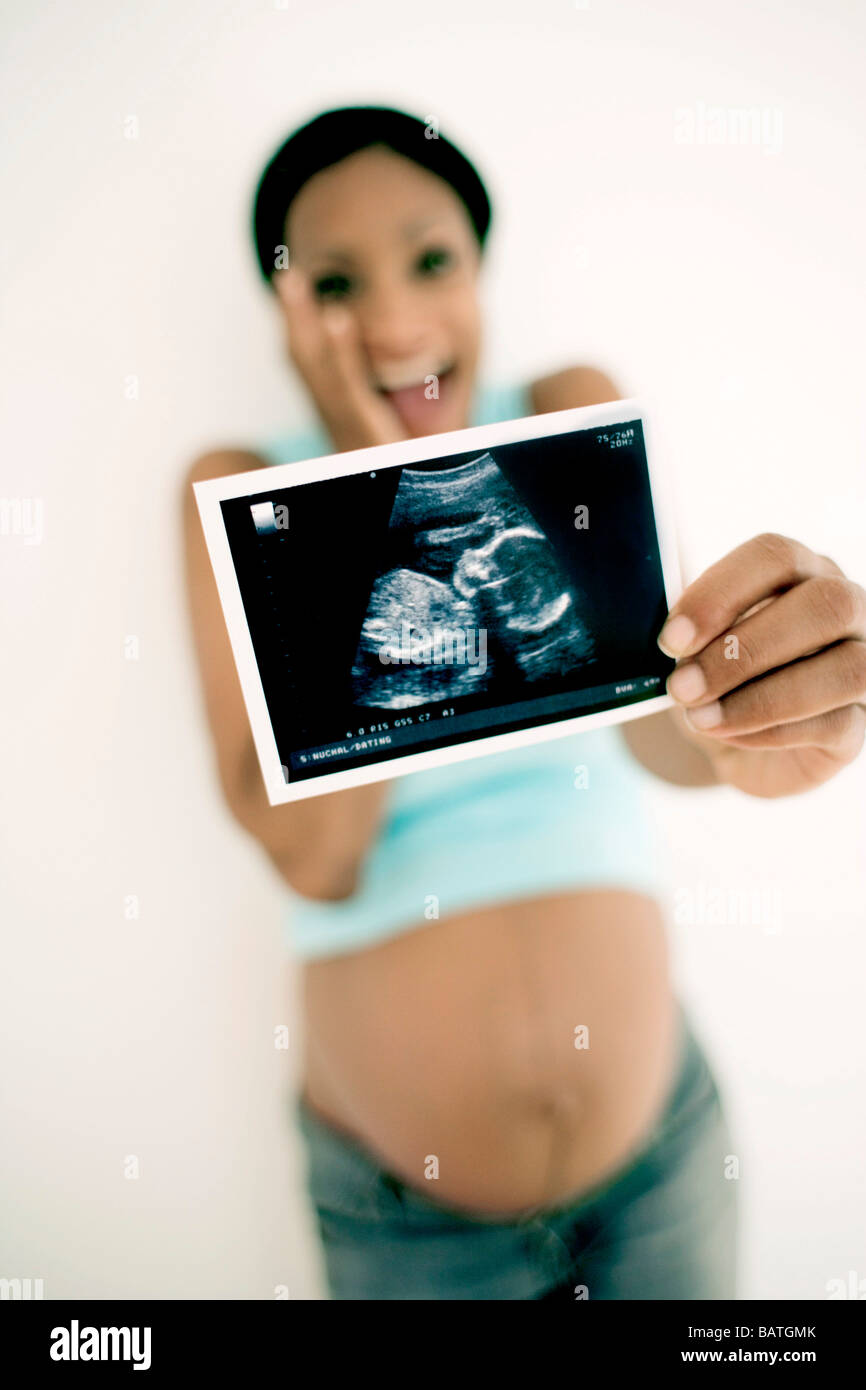 woman ultrasound scan of her unborn She is at full term Stock Photo - Alamy