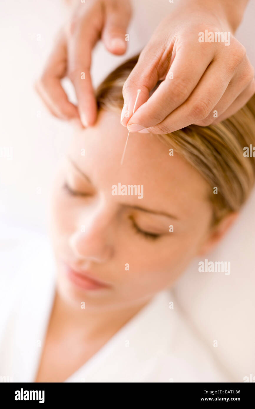 Acupuncture. Acupuncturist inserting a needle into a client's forehead