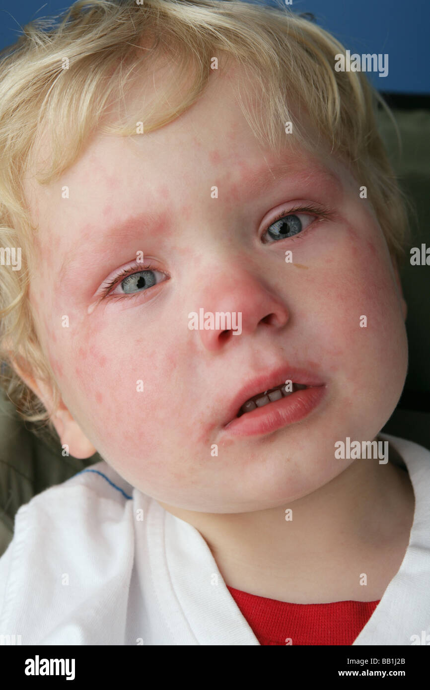 Close up of a child who has just finished crying and still has tears in his  eyes and a red face Stock Photo - Alamy