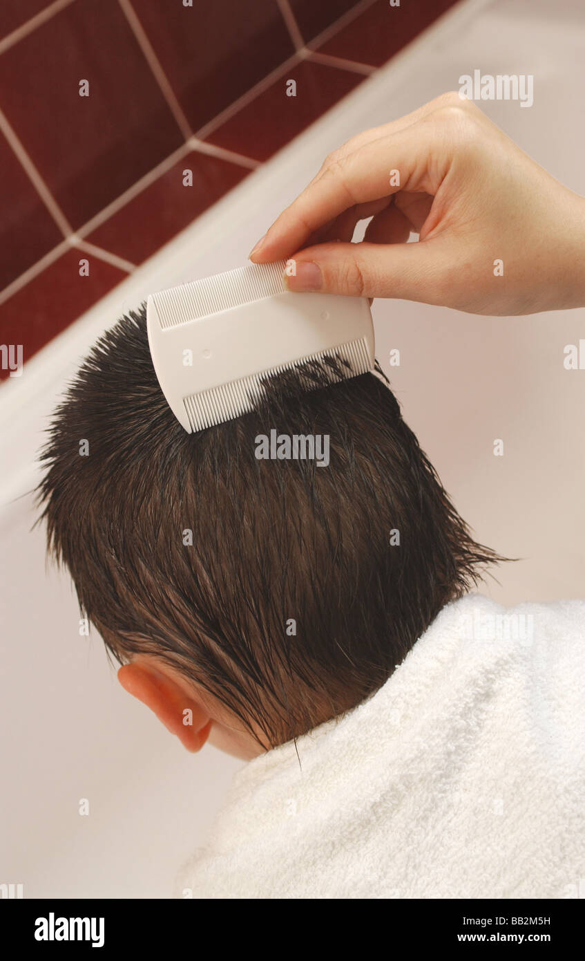 a boy being checked for head lice by his parents Stock Photo Alamy