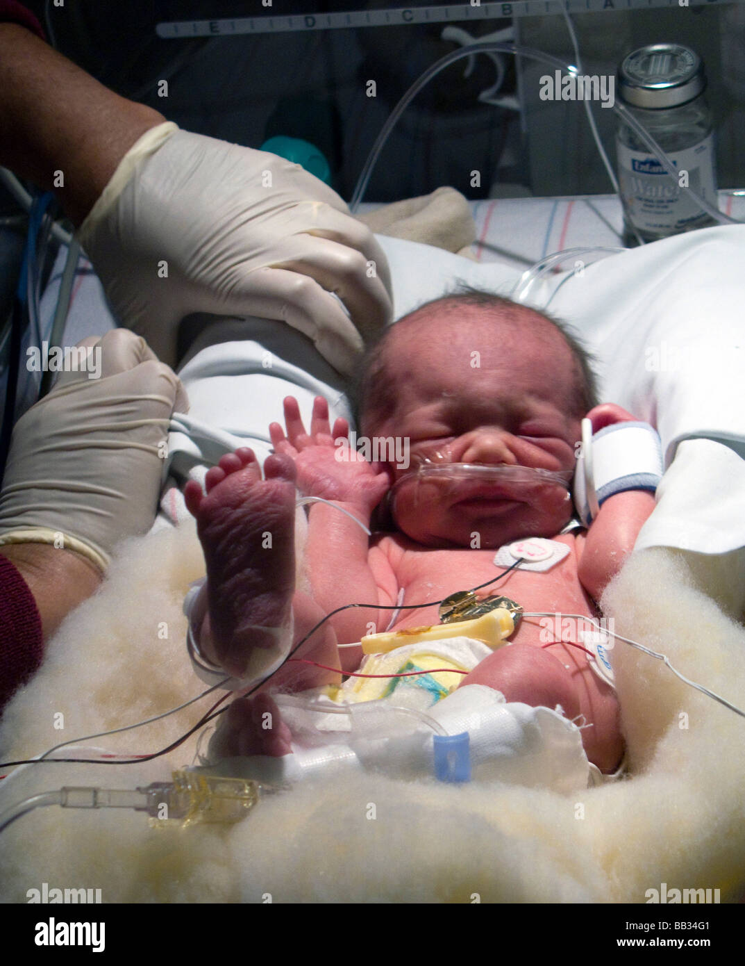 Newborn infant recieving nursing care in NICU with oxygen at Boston's Stock Photo 24041025 Alamy