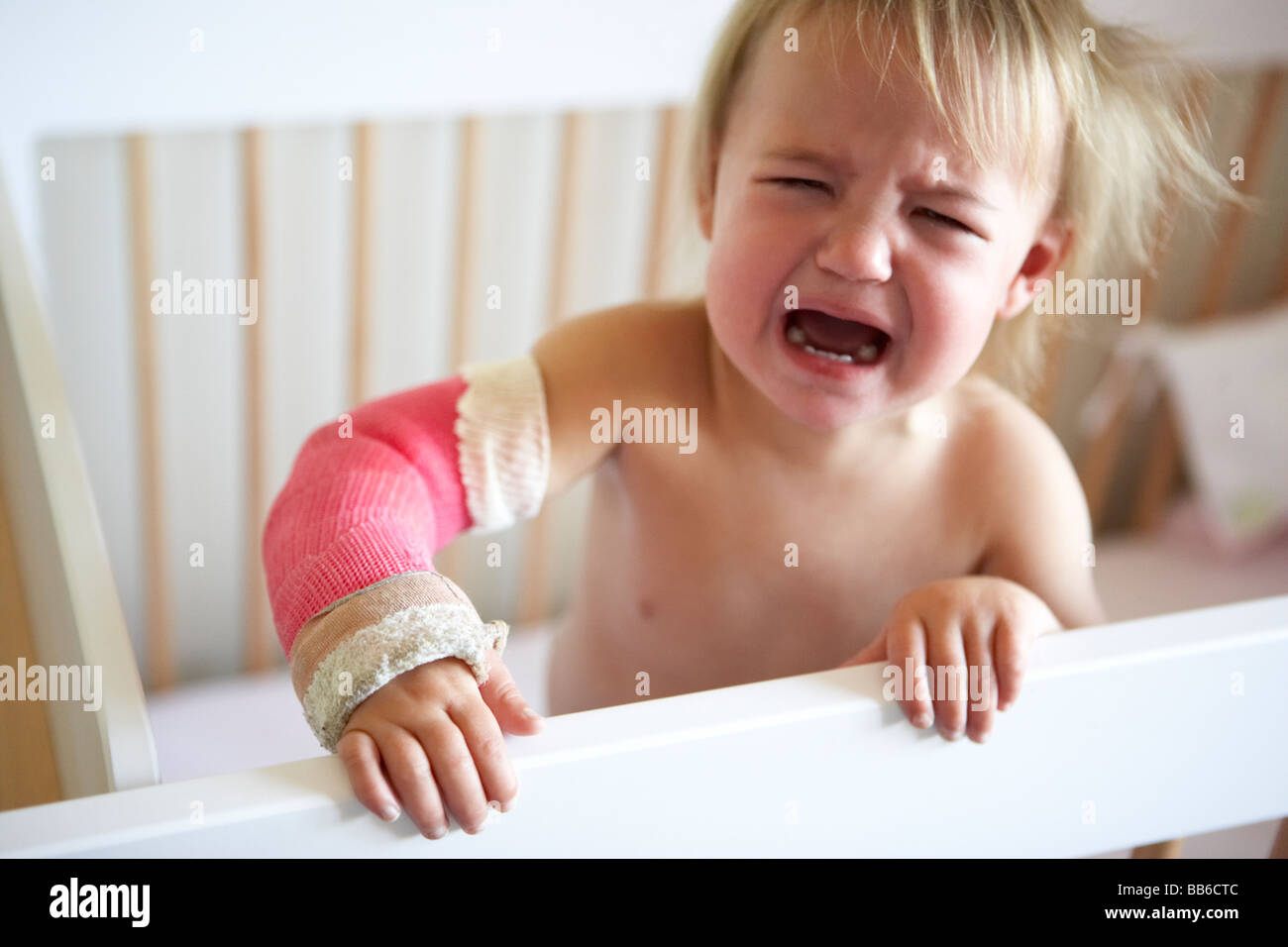 Crying Toddler With Arm In Cast Stock Photo