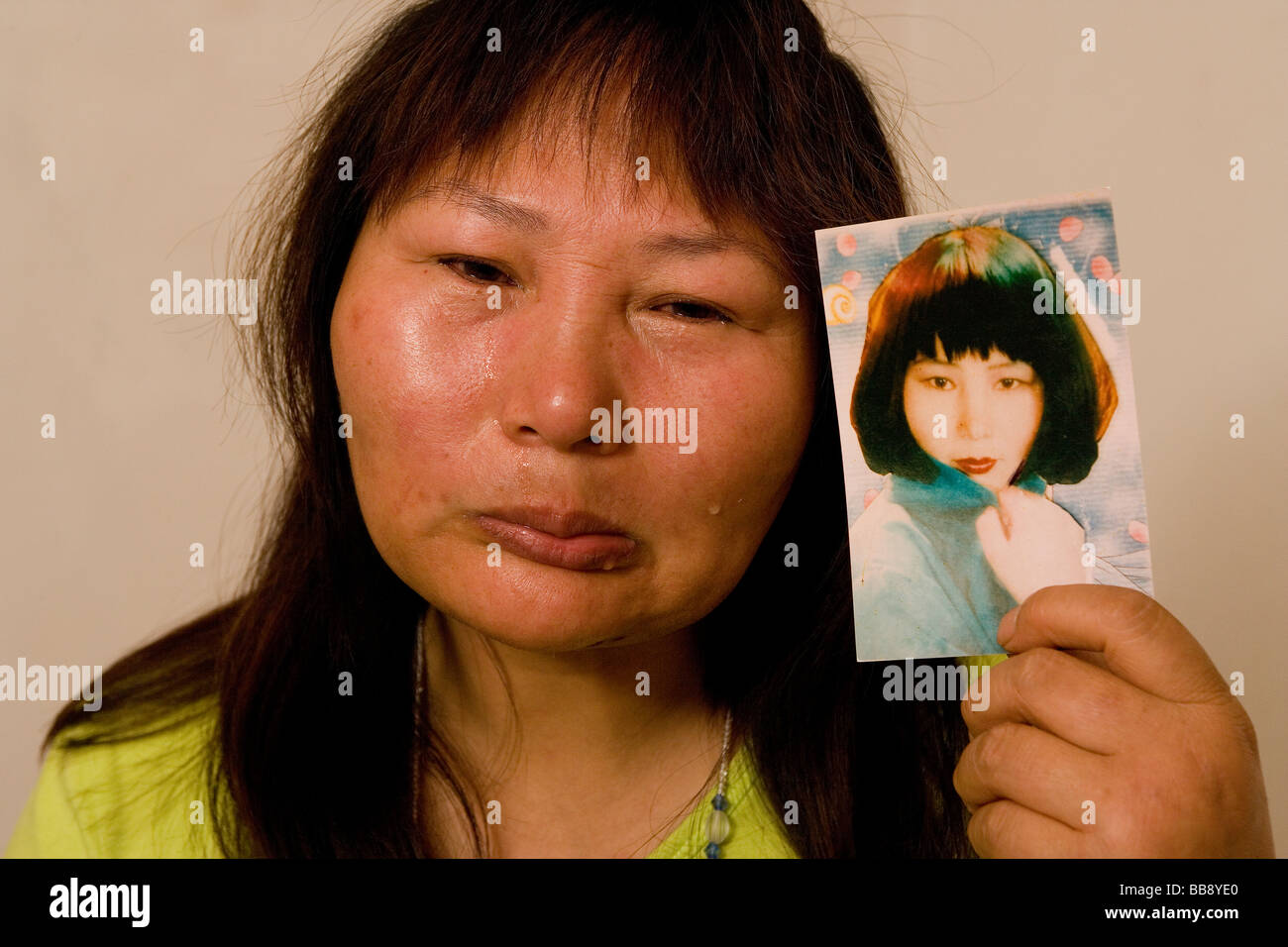 Disfigured Face Stock Photos & Disfigured Face Stock Images - Alamy