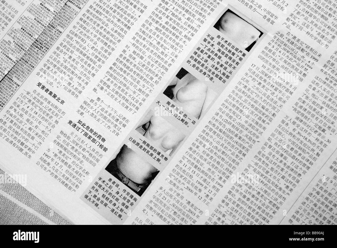 An article in a Chinese newspaper showing damage to women's bodies from the use of Ao Mei Ding in plastic surgery. Stock Photo