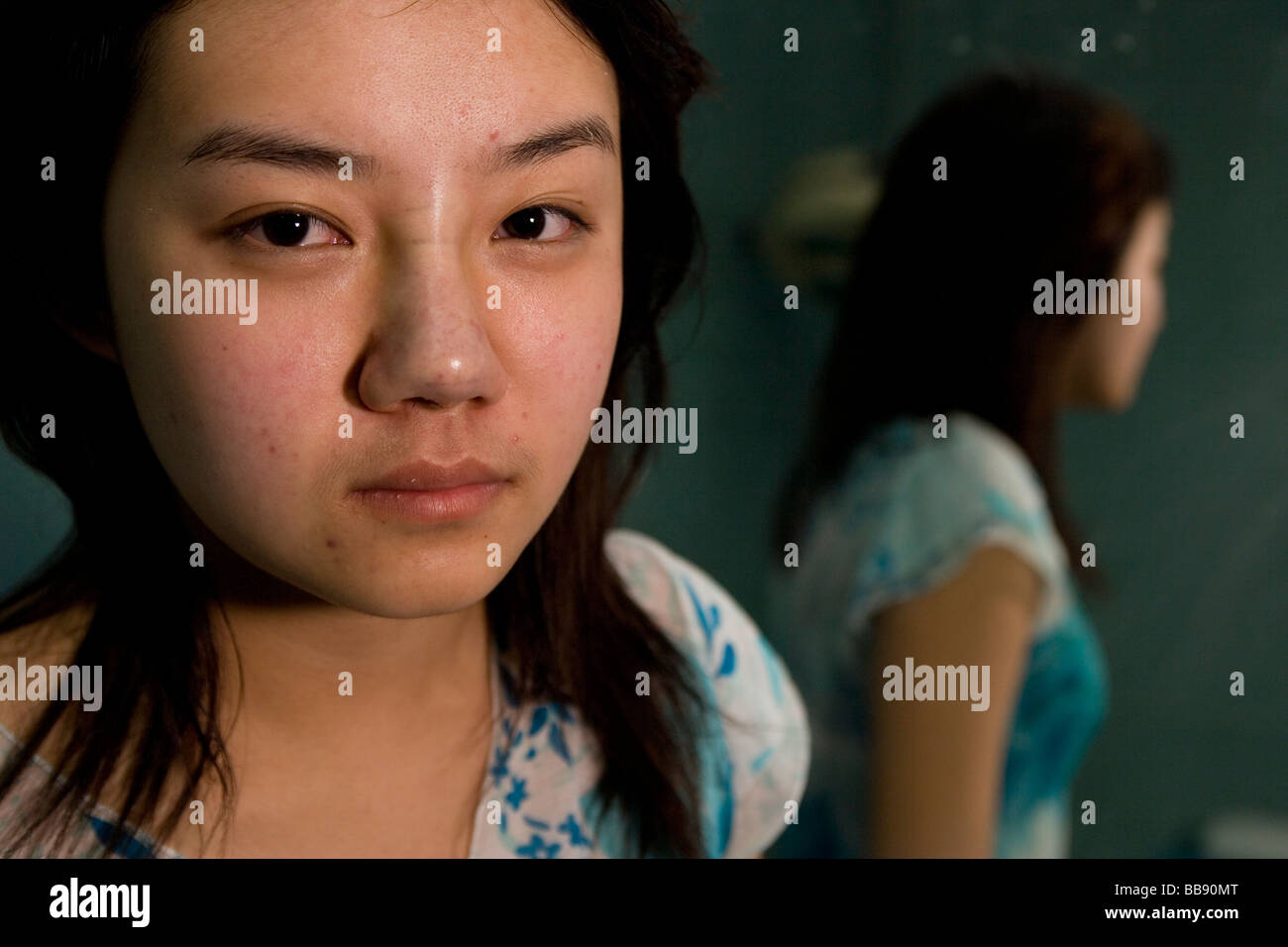 Bar Jing, 20, immediately after plastic surgery on her nose at the