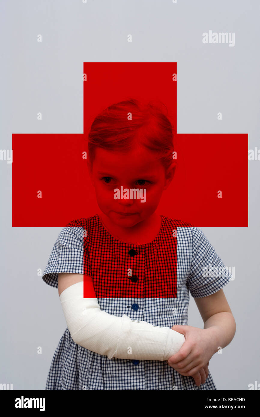 A young girl with a broken arm Stock Photo Alamy