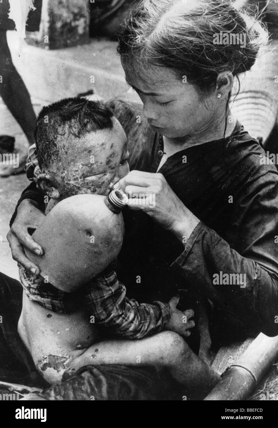 VIETNAM WAR South Cam Che Badly burned Vietnamese baby caught in bursting napalm bomb between US Marines and North Vietnamese Stock Photo