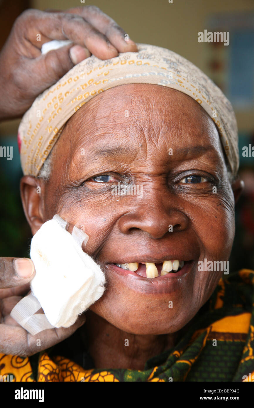 Removing the bandages after a cataract operation, Tanzania, East Africa Stock Photo