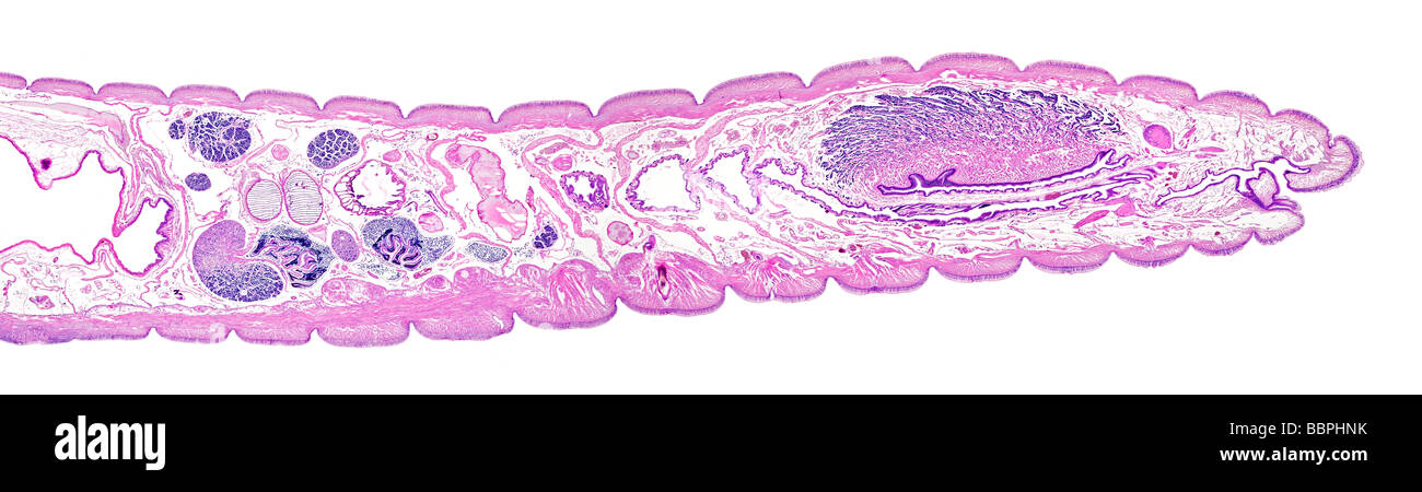 Lumbricus earthworm anterior region LS brightfield photomicrograph Stock Photo