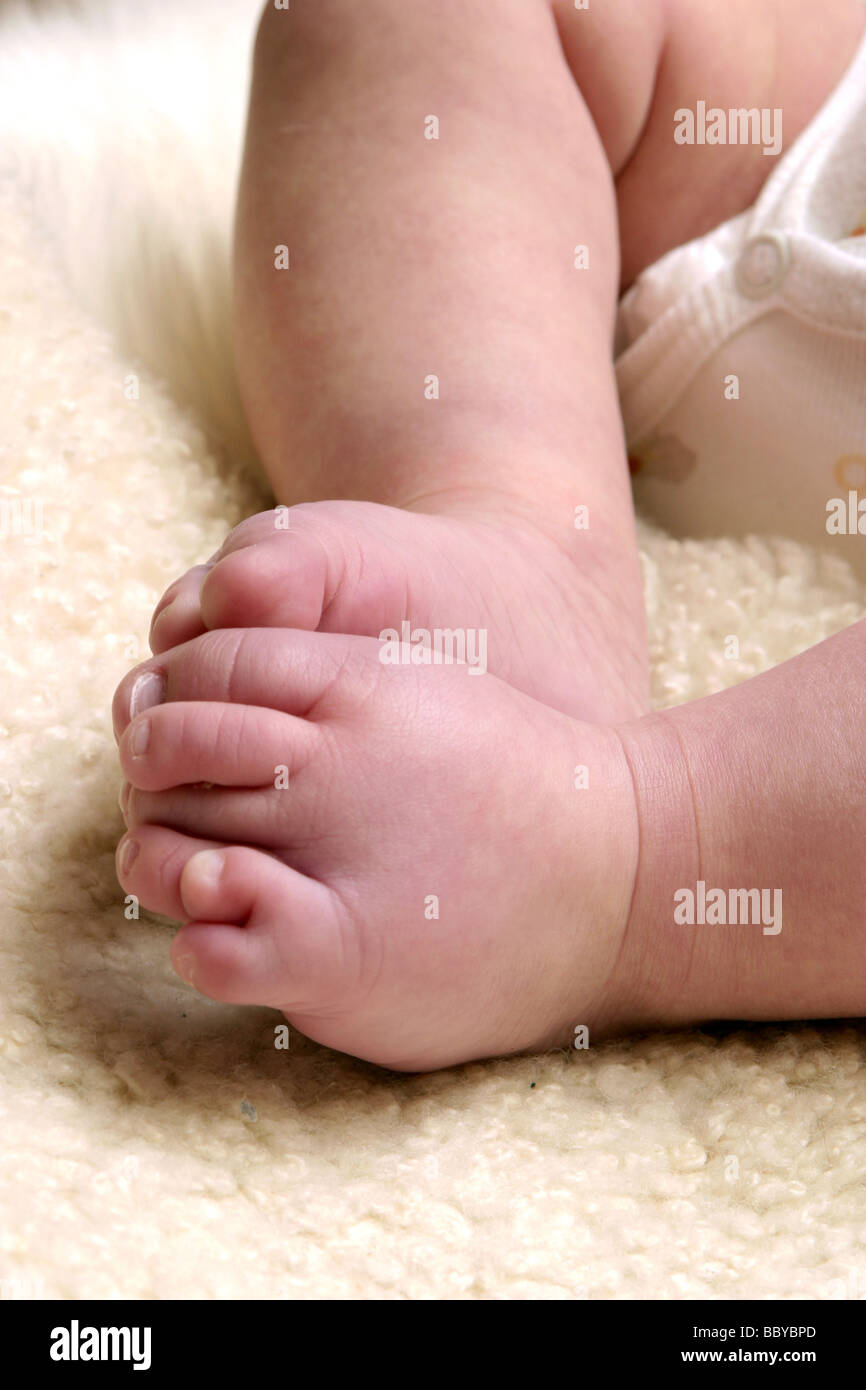 Close up six toes on newborn baby foot, showing so called extra digit