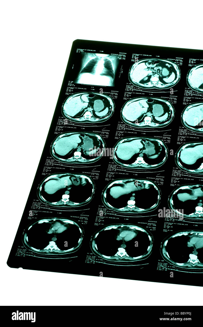 Diagnostic scans Cut Out Stock Images & Pictures - Alamy