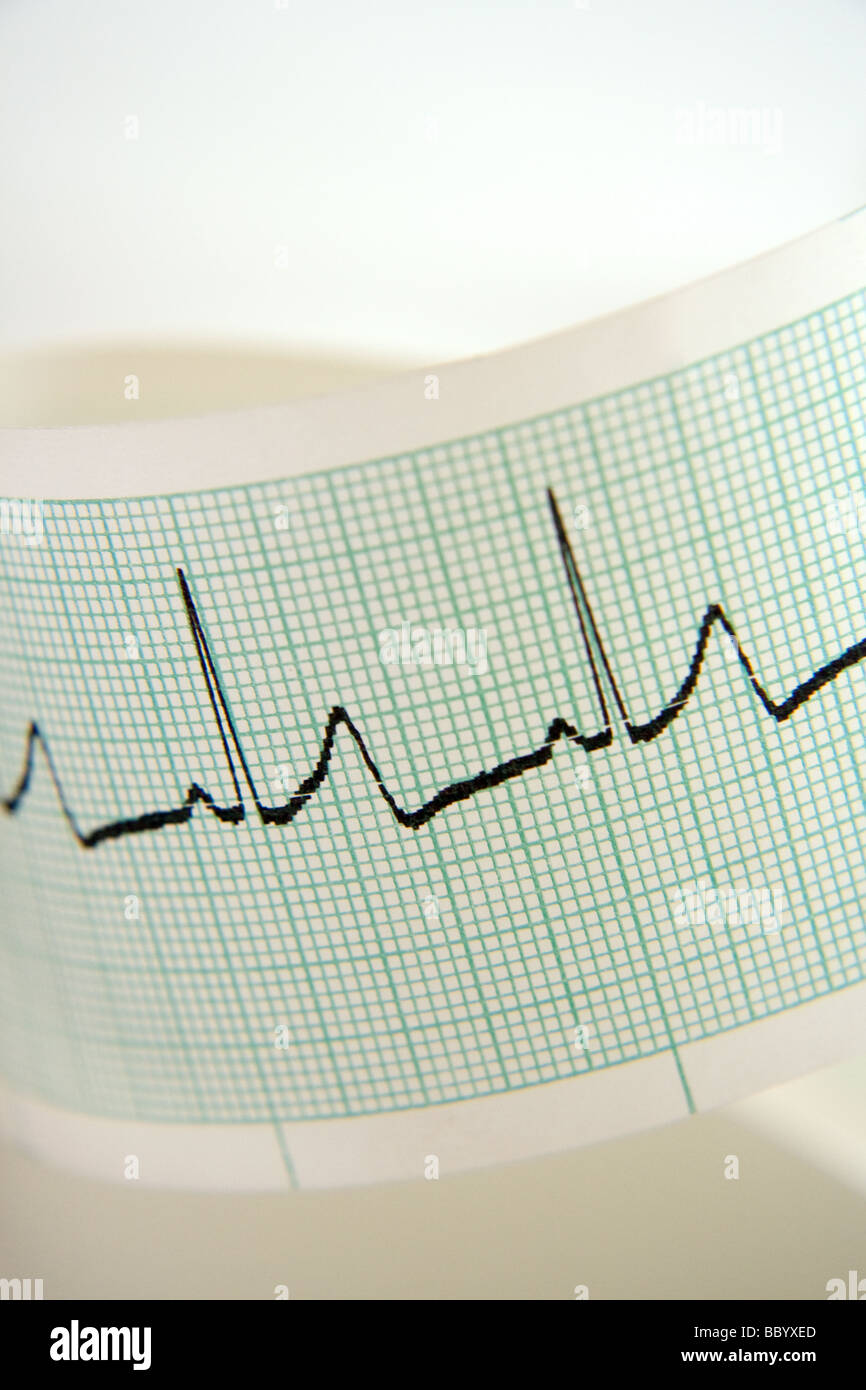 EKG tracing printout Stock Photo