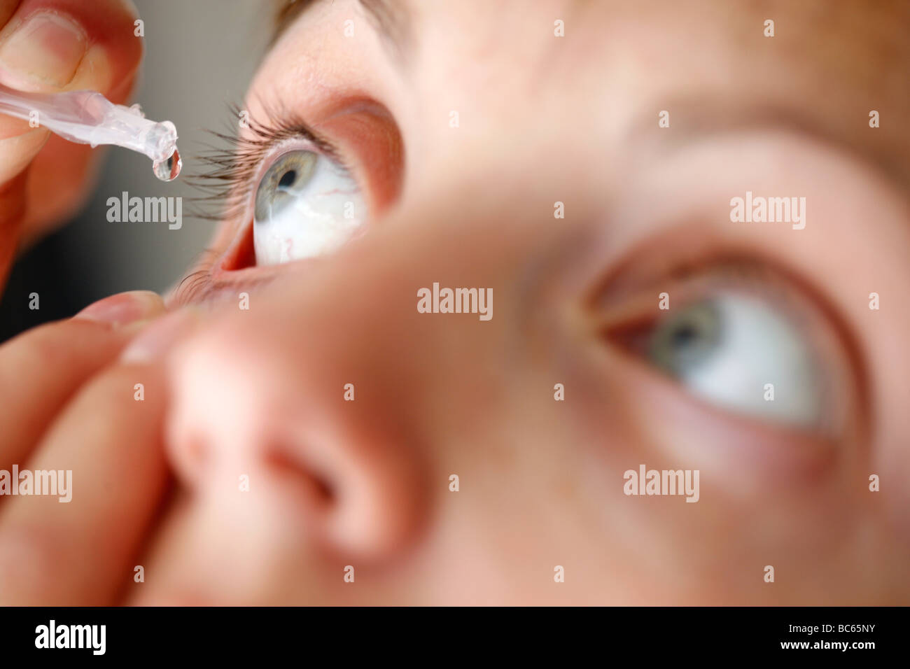 Woman is droping eyedrops into her eye Stock Photo