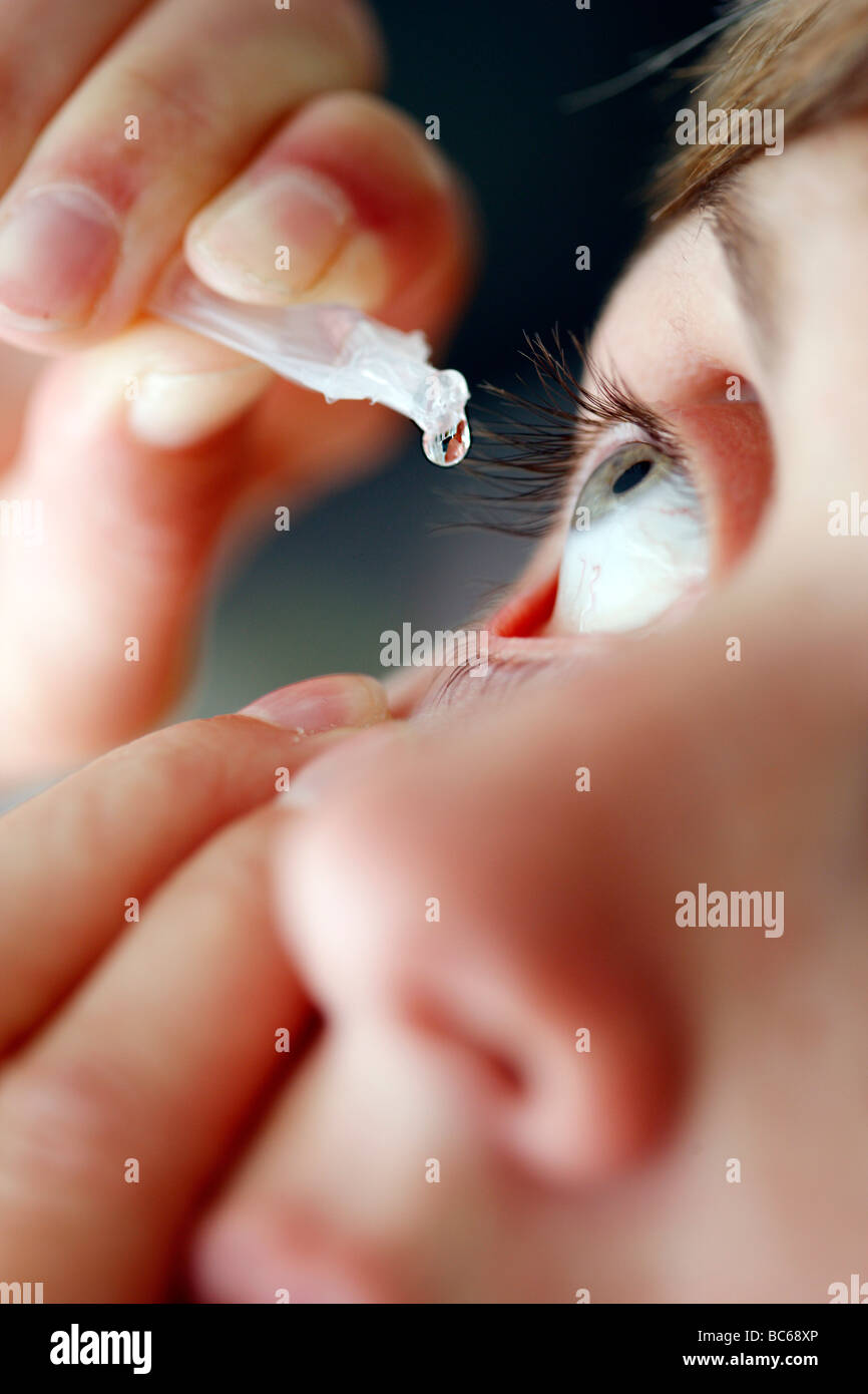 Woman drops eye drops in her eye. Medicine. Stock Photo