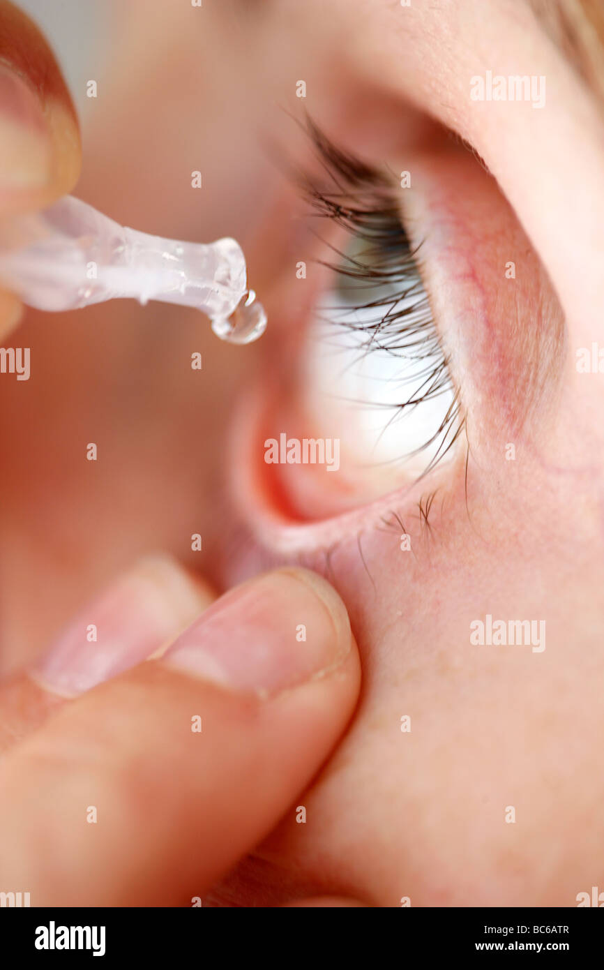 Woman is droping eyedrops into her eye Stock Photo