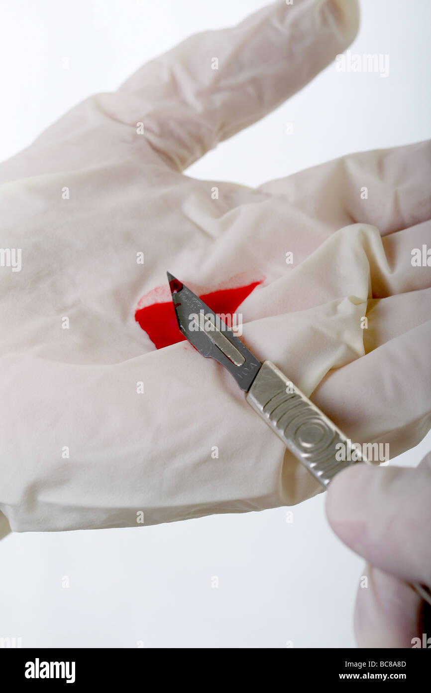 Scalpel with human blood on latex glove Stock Photo