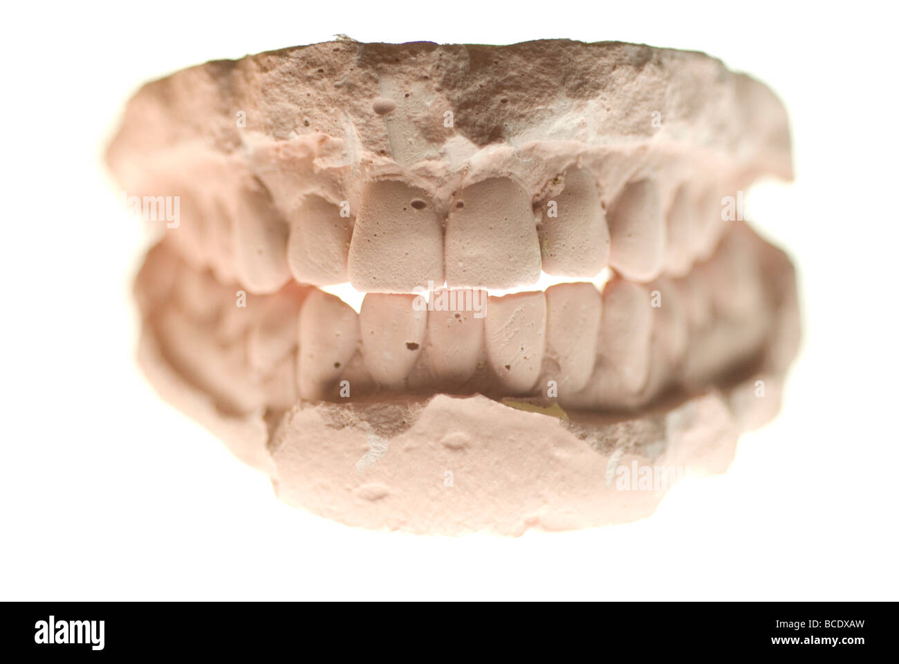 dental cast plaster model Stock Photo